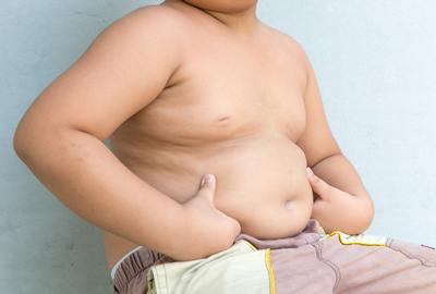 obesity risk